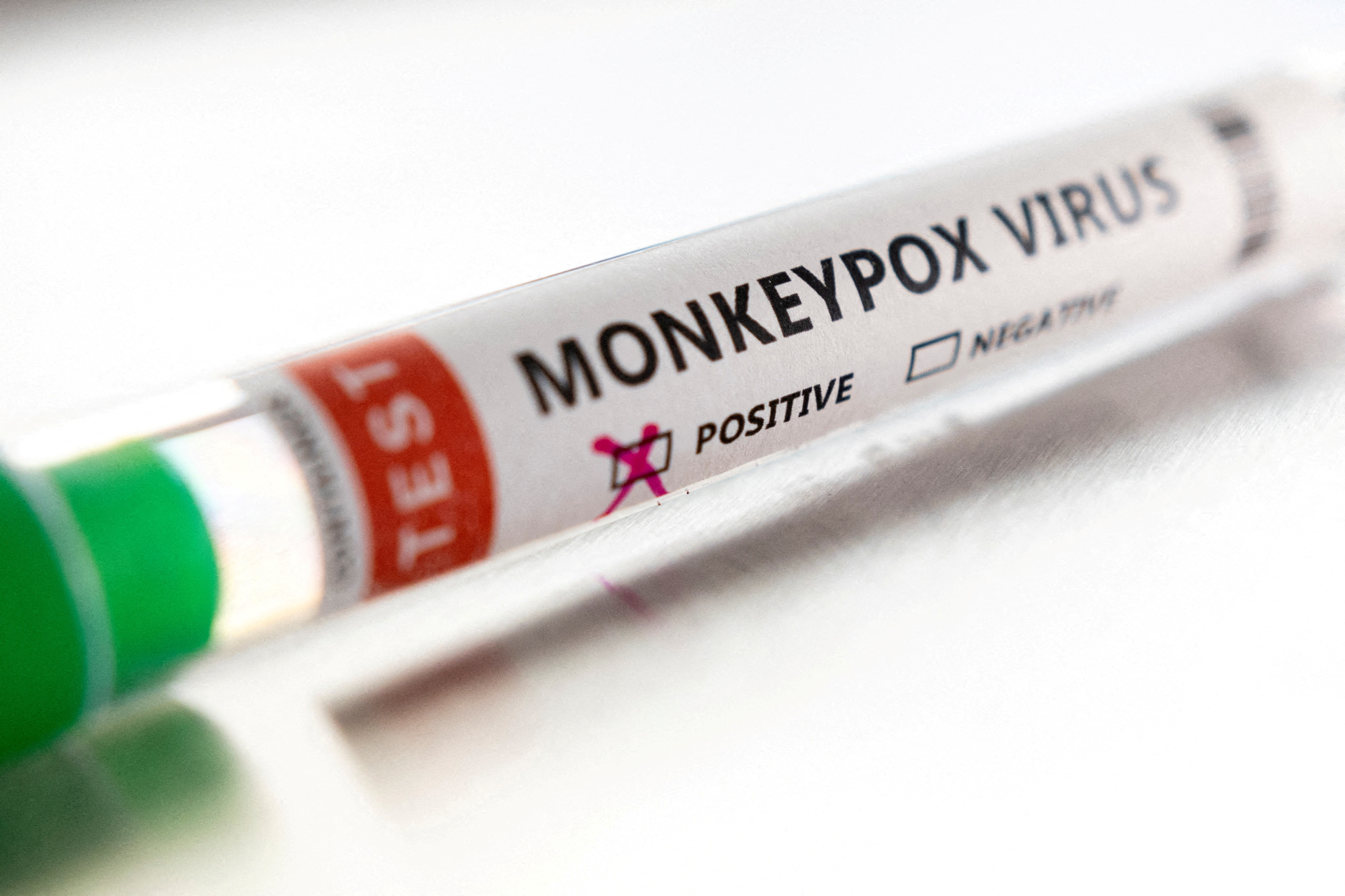 The National Institute for Communicable Diseases warns that South Africa could record more cases of the monkey-pox virus