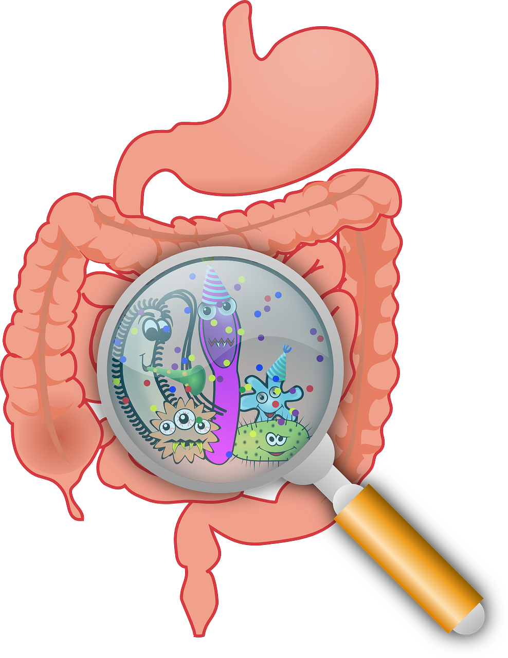 cholera disease 