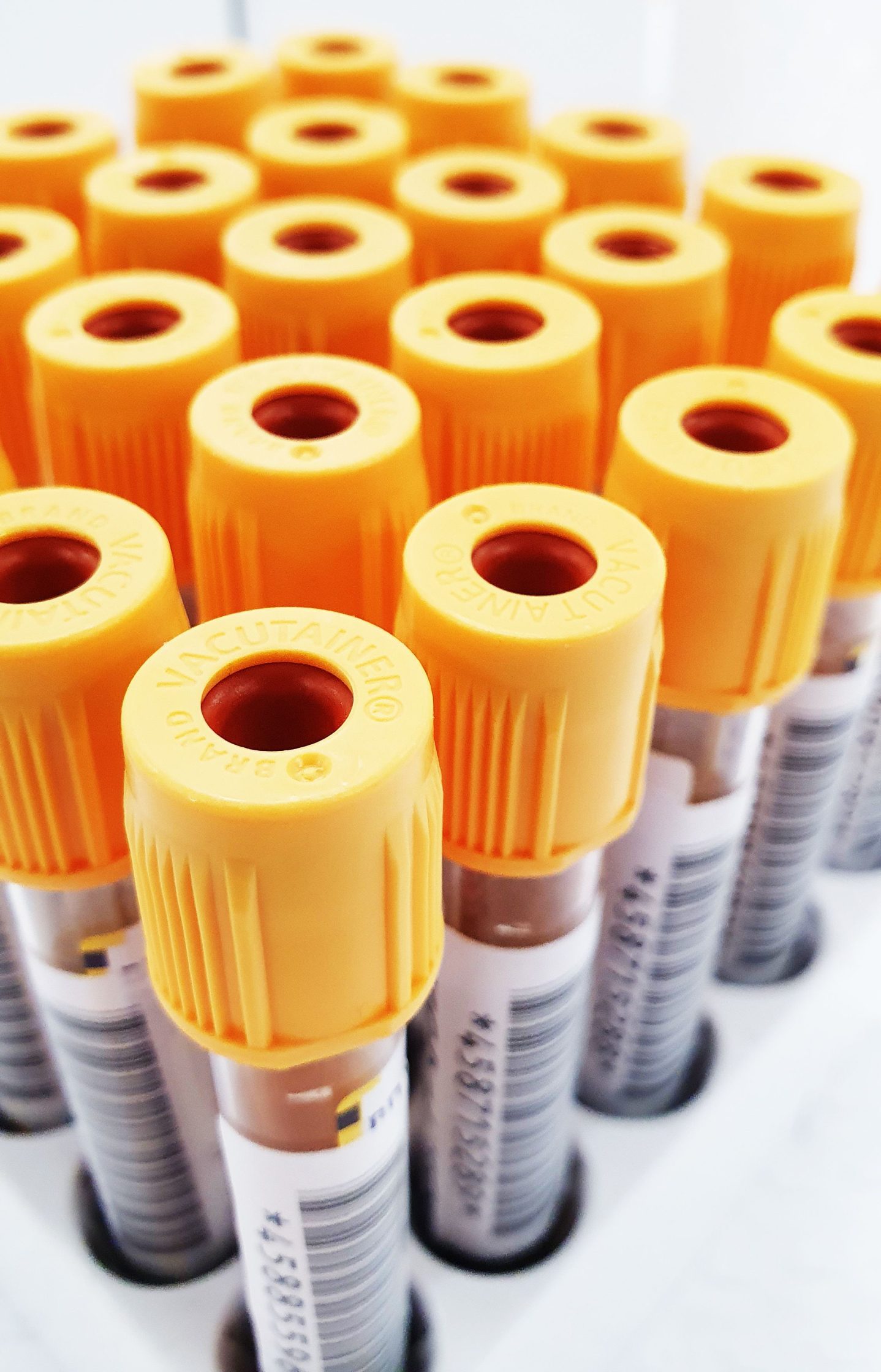 COURT: A man who intentionally infected his girlfriend with HIV