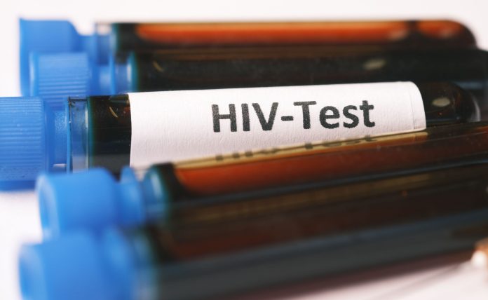 COURT: A man who intentionally infected his girlfriend with HIV